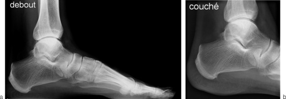 Radio Du Talon Du Pied Radiographie Du Pied Doctolib PTOMO Radio Du Talon Du Pied Radiographie Du Pied Doctolib PTOMO