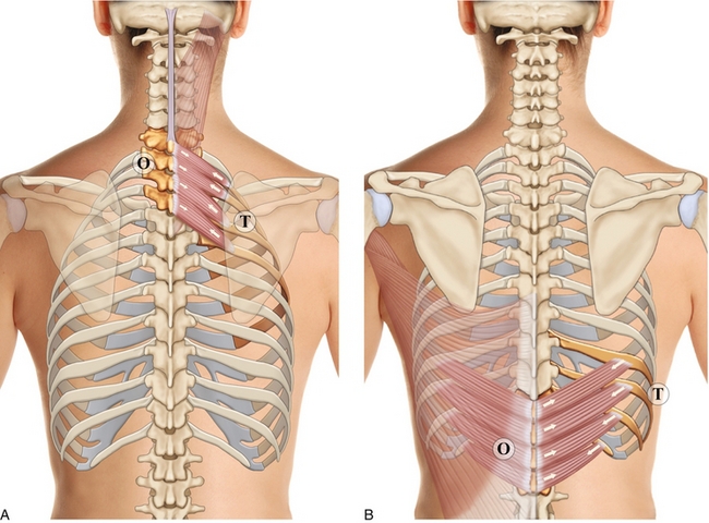 8: Muscles du rachis et de la cage thoracique | Medicine Key