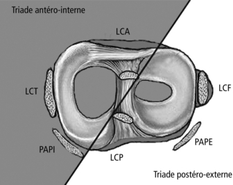 357 (Item 257): Lésions Ligamentaires Et Méniscales Du Genou Et De La ...