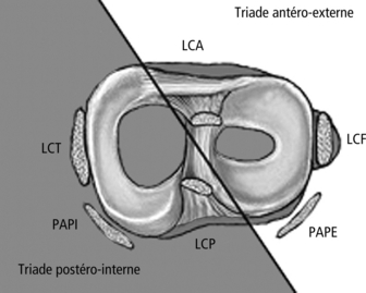 357 (Item 257): Lésions Ligamentaires Et Méniscales Du Genou Et De La ...